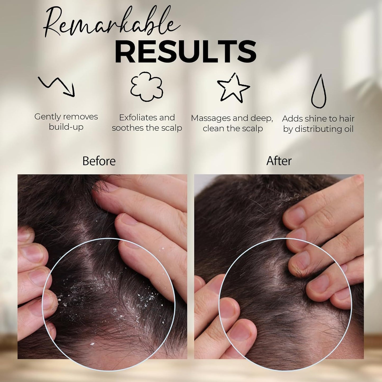 Scalp Shampoo Brush - Silicon Scalp Scrubber And Exfoliator